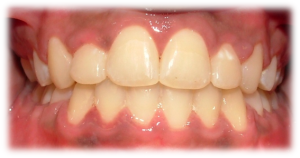 After-Front-300x158