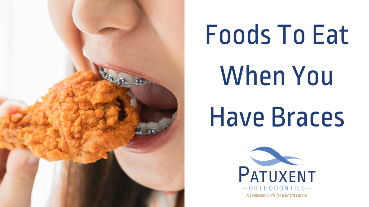 Foods to Eat When You Have Braces