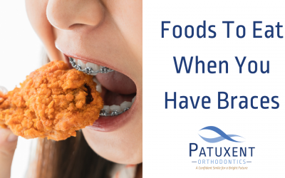 Foods to Eat When You Have Braces
