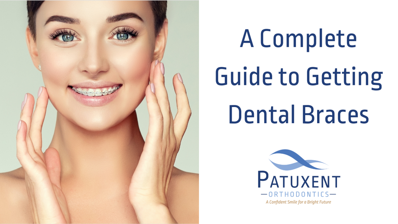 A 101 Guide to Getting Dental Braces Patuxent Orthodontics