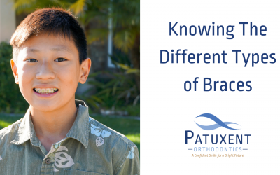 Let’s Discuss the Different Types of Braces for You!