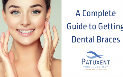 A Complete Guide to Getting Dental Braces