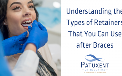 The Types of Retainers You Can Use After Braces!