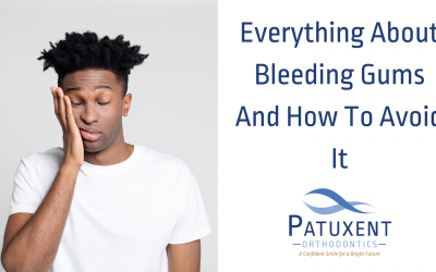 Everything About Bleeding Gums and How to Avoid Them