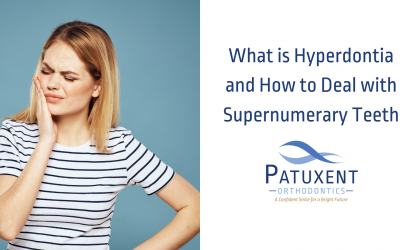 What is Hyperdontia and How Can I Deal With Supernumerary Teeth?