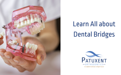 Learn All About Dental Bridges!