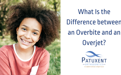 What is the Difference Between an Overbite and an Overjet?