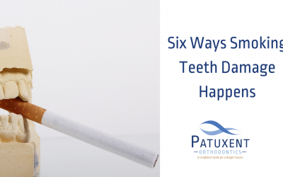 6 Ways Smoking Teeth Damage Happens