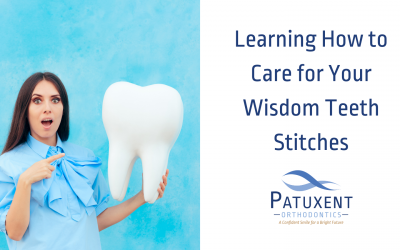 Learning How to Care for Your Wisdom Teeth Stitches
