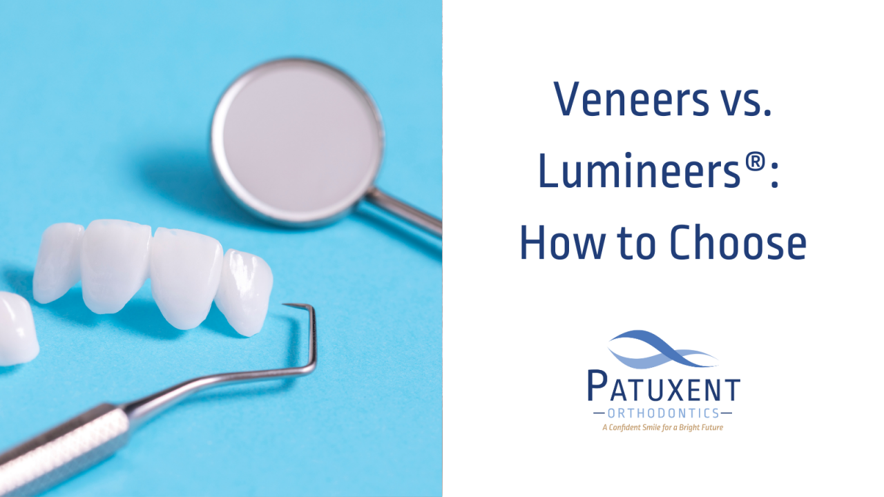 Veneers vs. Lumineers How to Choose