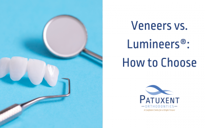 Veneers vs. Lumineers: How to Choose