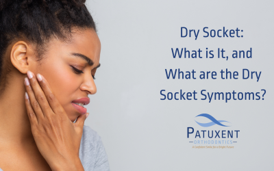 Dry Socket: What is It, and What are the Dry Socket Symptoms?