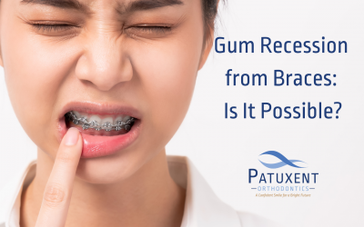 Gum Recession From Braces: Is It Possible?