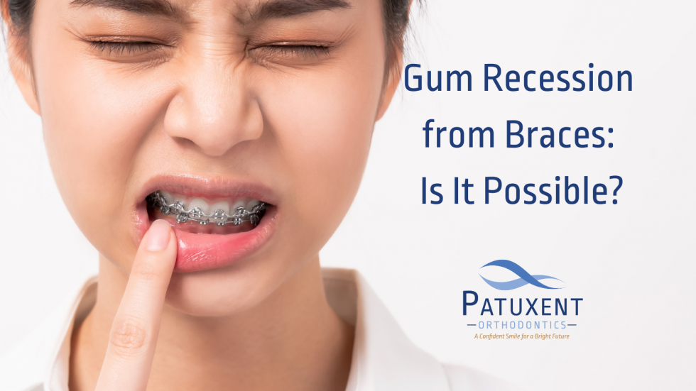 receding gums braces Patuxent Orthodontics