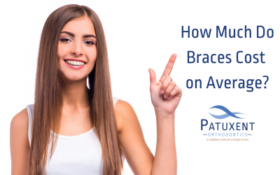How Much Do Braces Cost on Average?