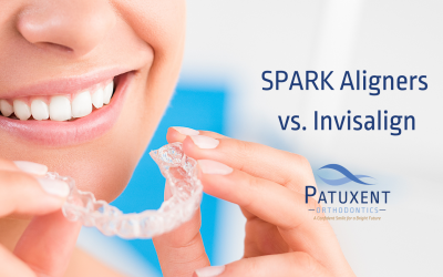 SPARK Aligners vs. Invisalign