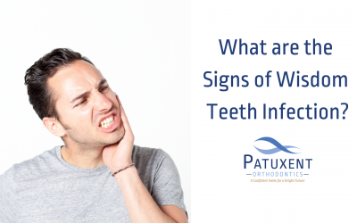 What are the Signs of Wisdom Teeth Infection?