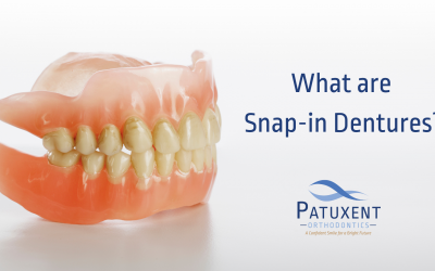 What are Snap-in Dentures?