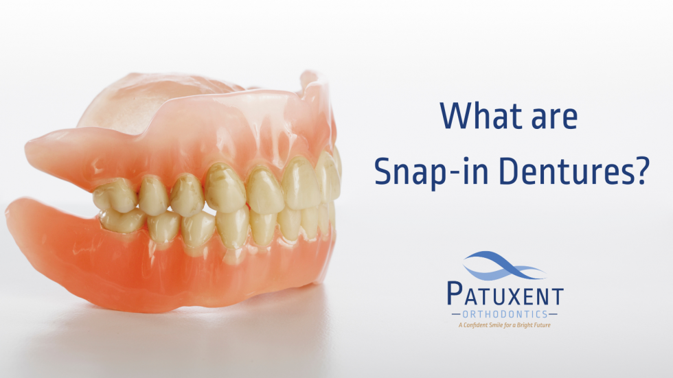 What are Snapin Dentures? Patuxent Orthodontics