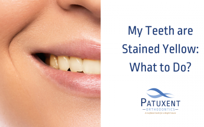 My Teeth are Stained Yellow: What to Do?