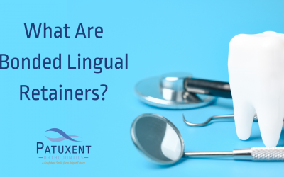 What are Bonded Lingual Retainers?