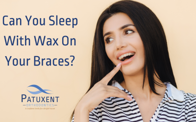 Can You Sleep With Wax on Your Braces?