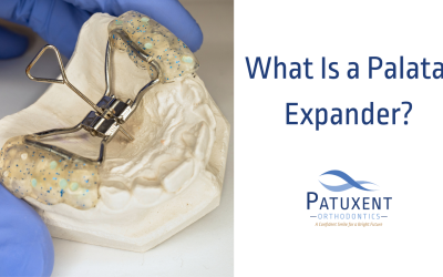 What is a Palatal Expander?