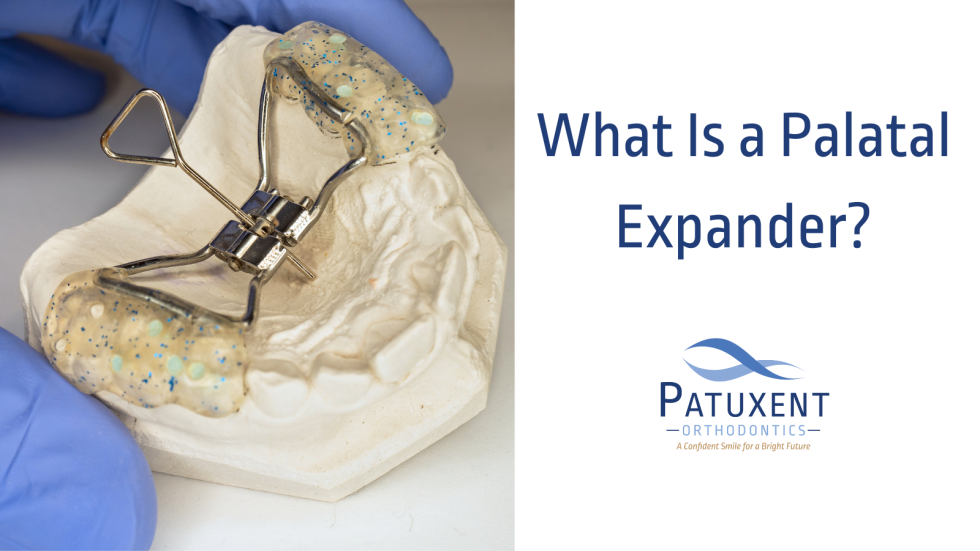 What is a Palatal Expander?