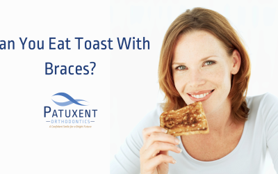 Can You Eat Toast With Braces?