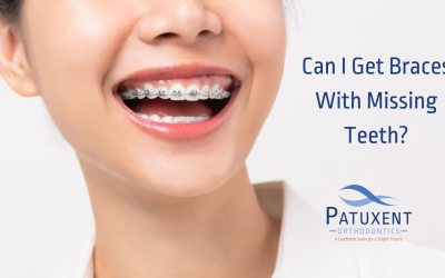 Can I Get Braces With Missing Teeth?