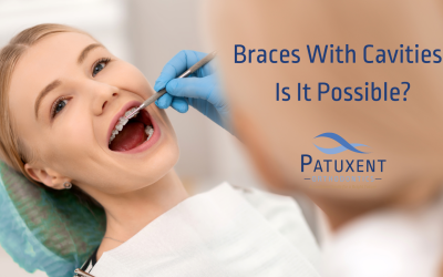 Braces With Cavities: Is It Possible?