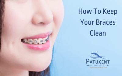 How to Keep Your Braces Clean