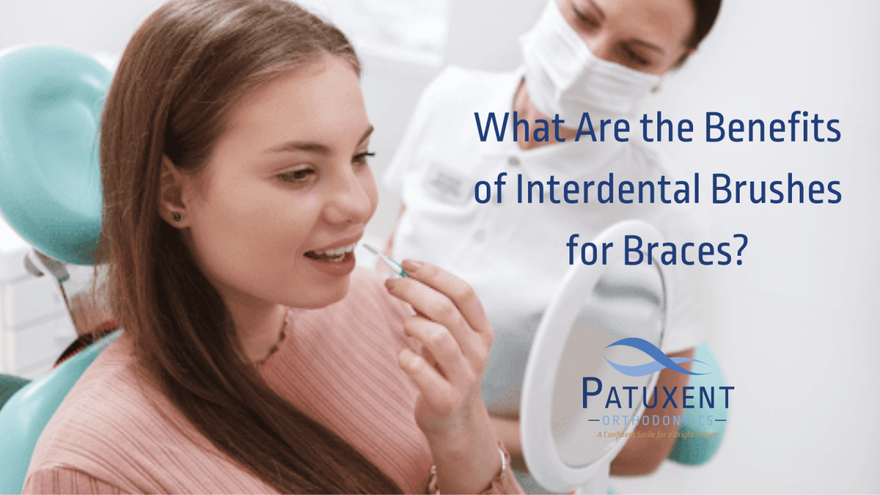 The 4 Stunning Benefits of Interdental Brushes for Braces!