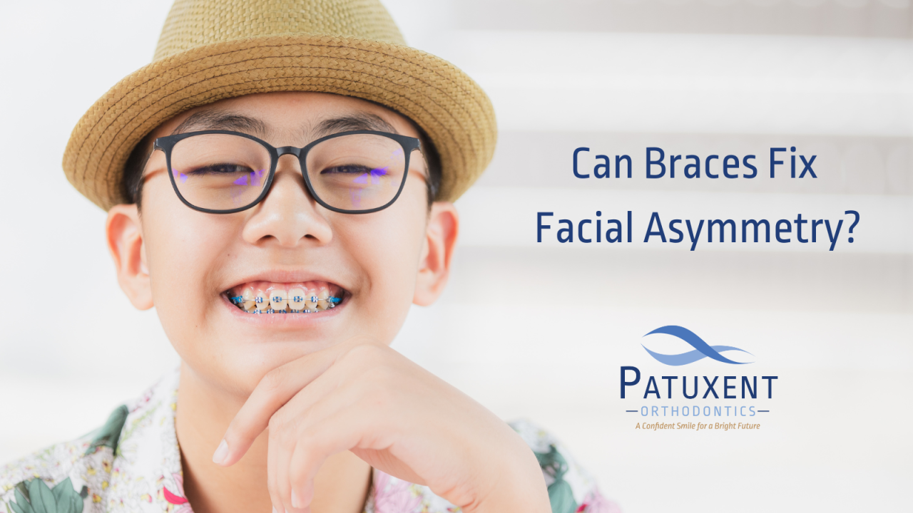 Can Braces Fix Facial Asymmetry?