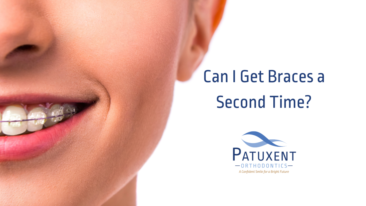 Can I Get Braces a Second Time?