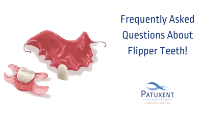 Frequently Asked Questions About Flipper Teeth!