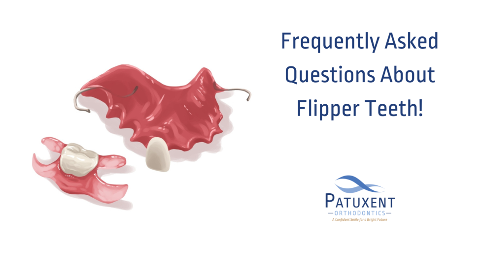 Frequently Asked Questions About Flipper Teeth!