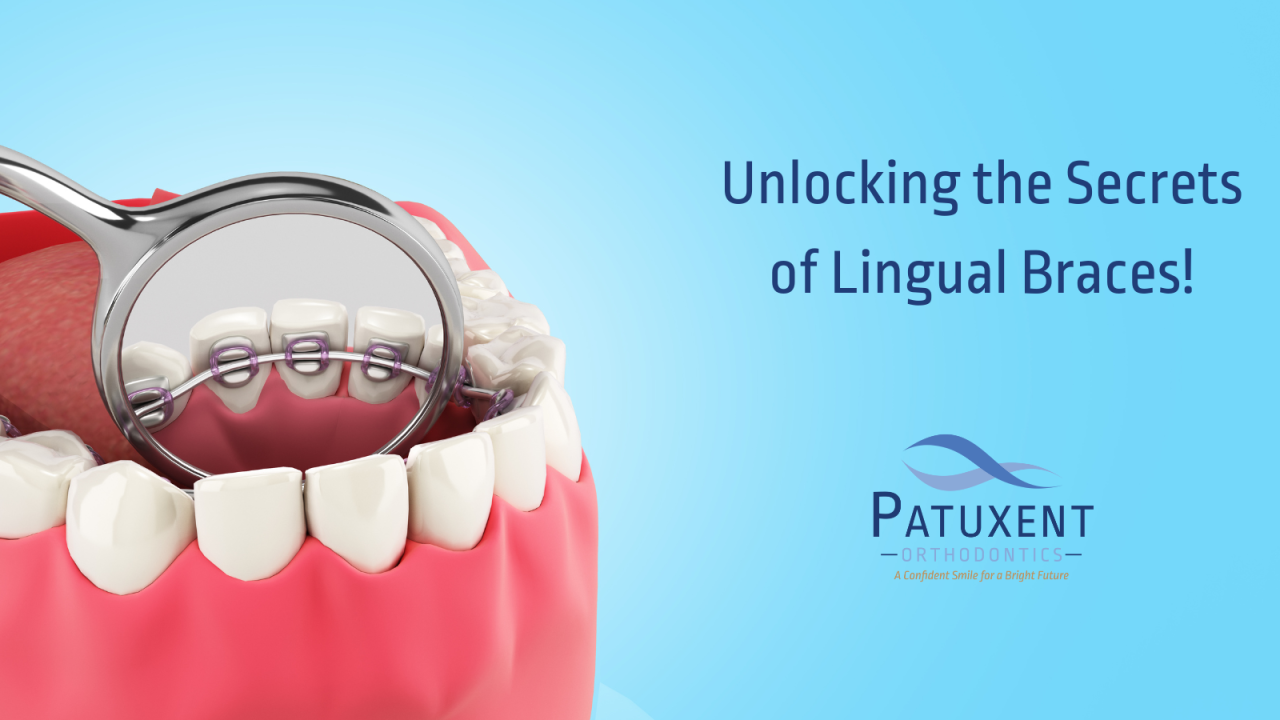 Unlocking the Secrets of Lingual Braces!