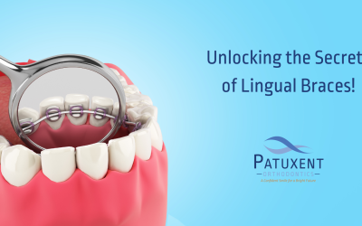 Unlocking the Secrets of Lingual Braces!