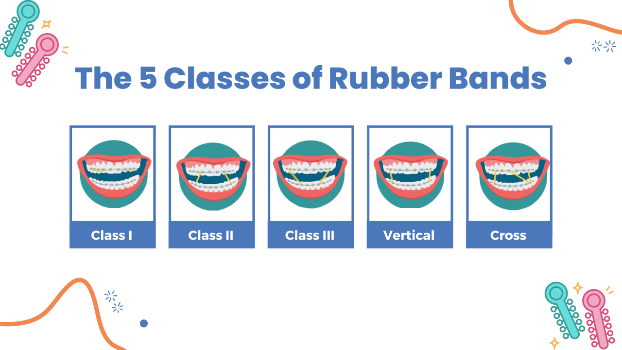 What Are the Rubber Bands for Braces Used For?