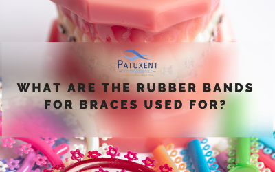 What Are the Rubber Bands for Braces Used For?
