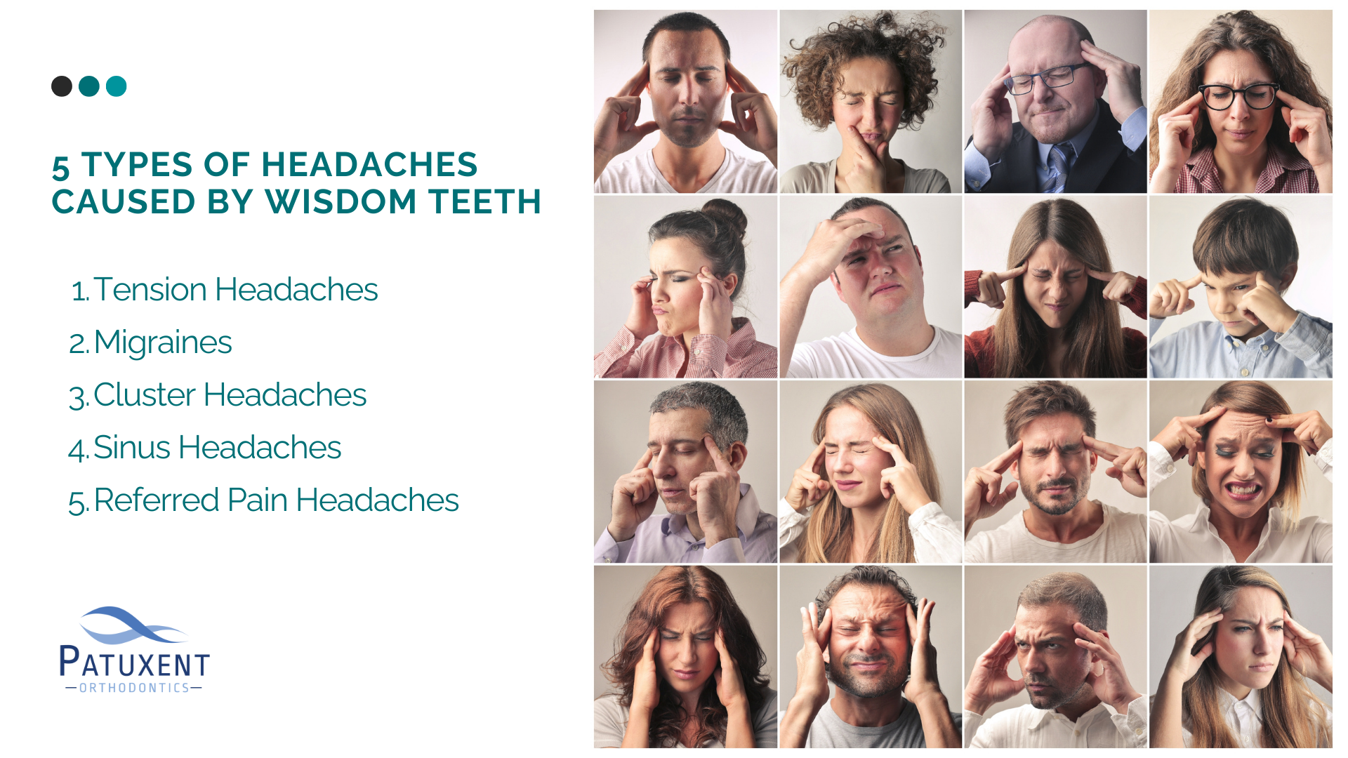 Types of Headaches Caused by Wisdom Teeth