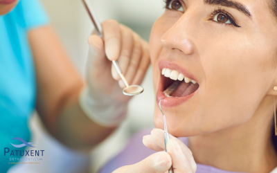 What Is the Ideal Wisdom Teeth Removal Age?