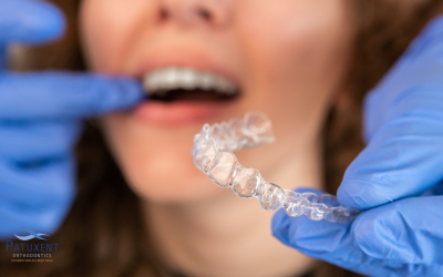 Can Invisalign Cause Gum Recession?