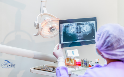 Orthodontic Challenges: The Reality of Adjusting Wisdom Teeth with Braces 