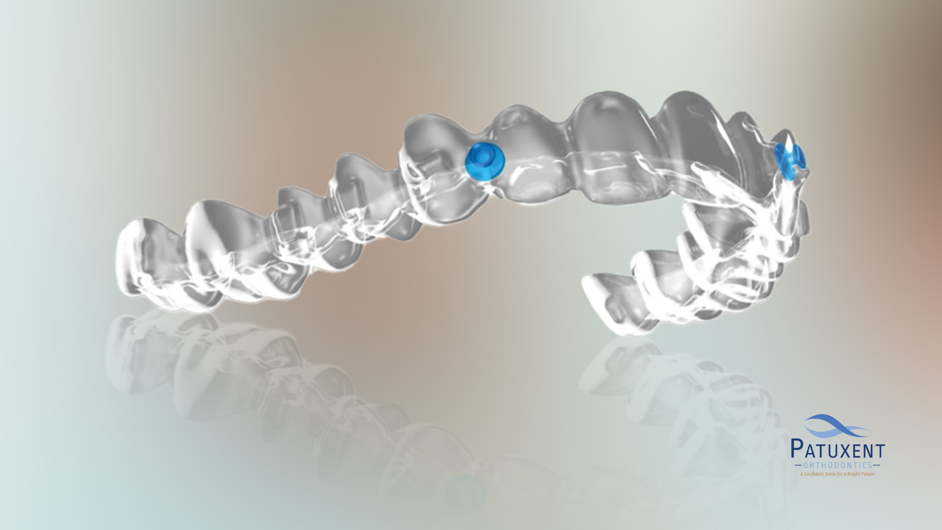 How the Angel Aligner Transforms Smiles in Hollywood, MD