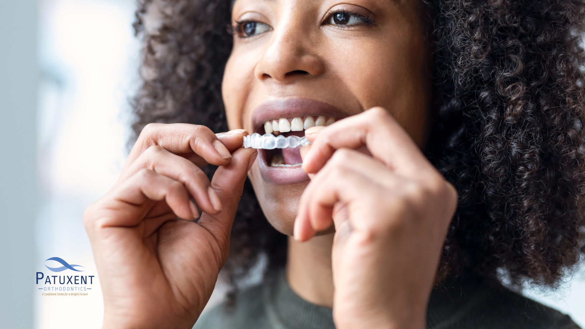 Angel aligner