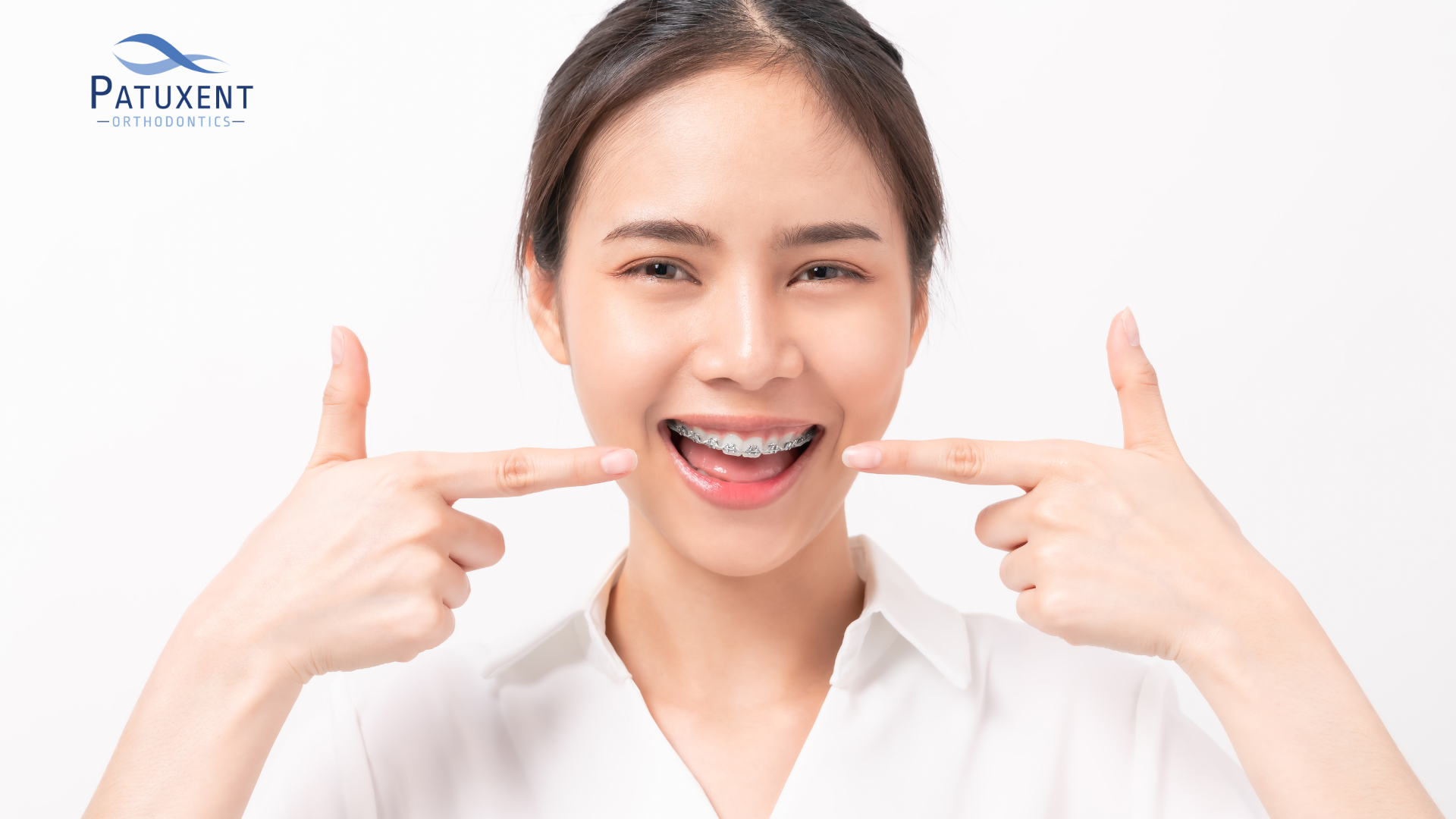 Ceramic braces in Hollywood, MD