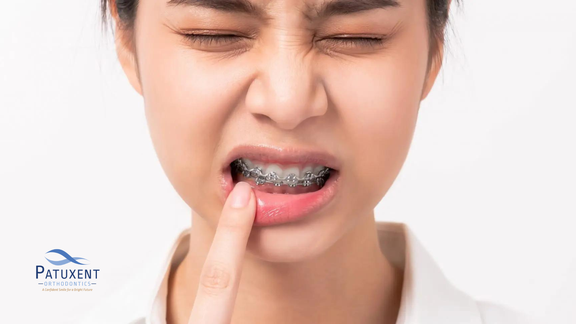 Woman with pain from braces