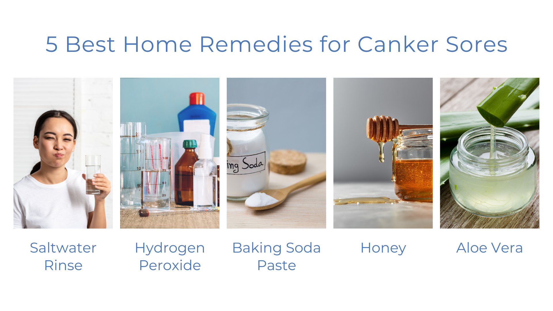 5 Best Home Remedies for Canker Sores